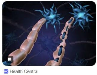 Featured image for “Two compounds with potential for myelin repair in MS identified”